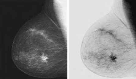 1561009866.png log-transformation1.png