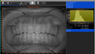 LightningChart.NET案例研究(六):东芬兰大学多光谱图像的数据可视化 LightningChart.NET案例研究(六):东芬兰大学多光谱图像的数据可视化